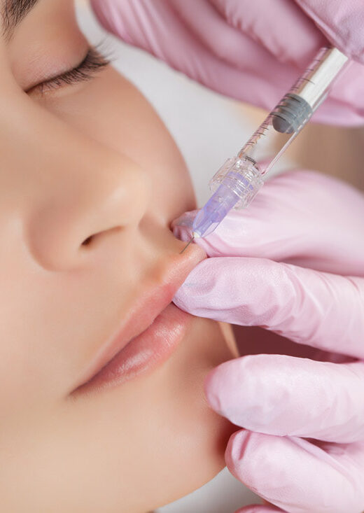 dermalfillerlip_orig